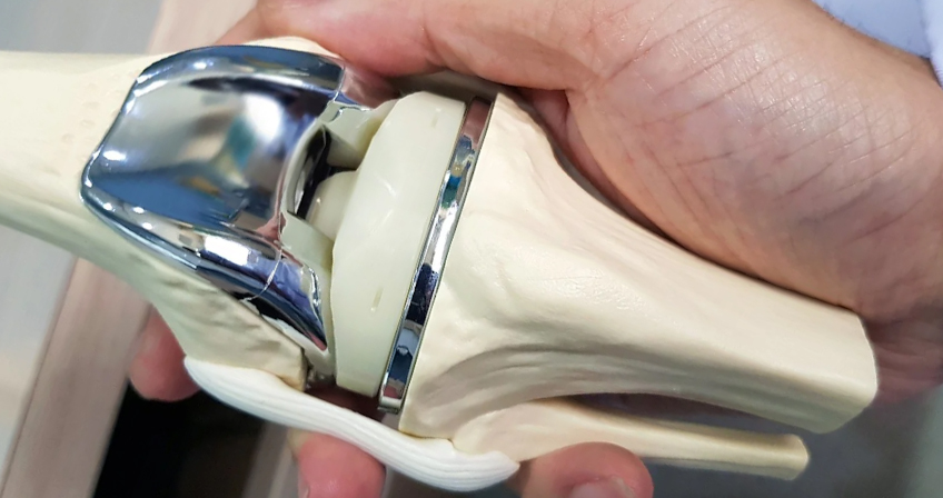 Knee joint replacement model
